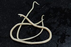 Close-up of white parasitic roundworms (Ascaris lumbricoides) against a dark background.
