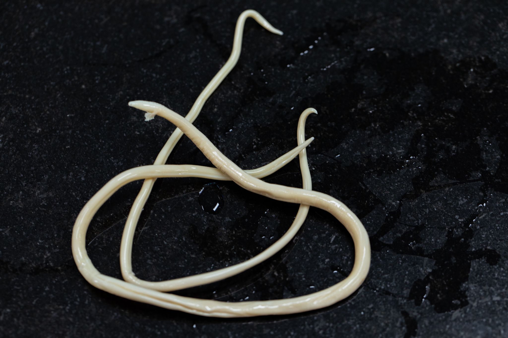 Close-up of white parasitic roundworms (Ascaris lumbricoides) against a dark background.